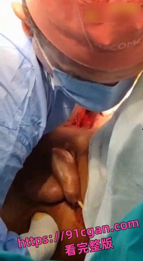 猎奇！拳头形状大玩具从屁股里拔出来的时候医生都憋不住笑了！-5