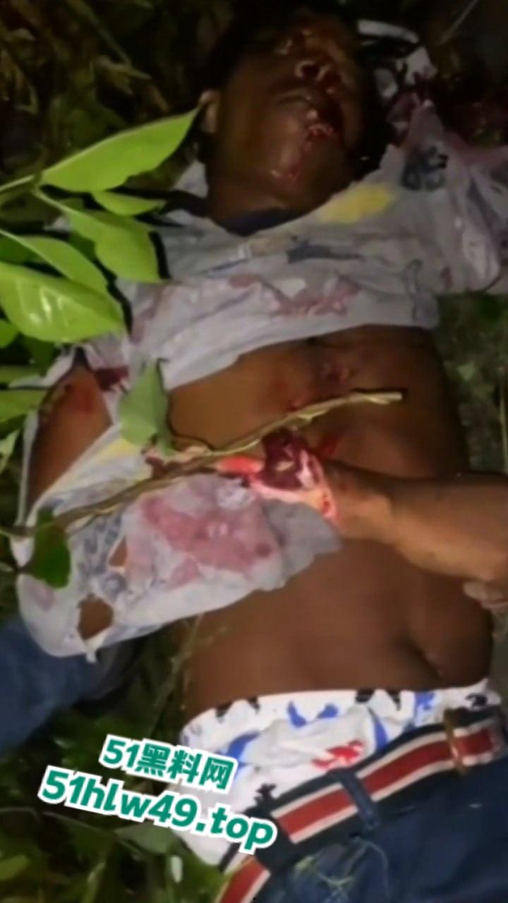 血腥恐怖，非洲南部车祸乡间公路步行，司机未看清路况当场将撞飞路人，手脚全断死相极其残忍。-6