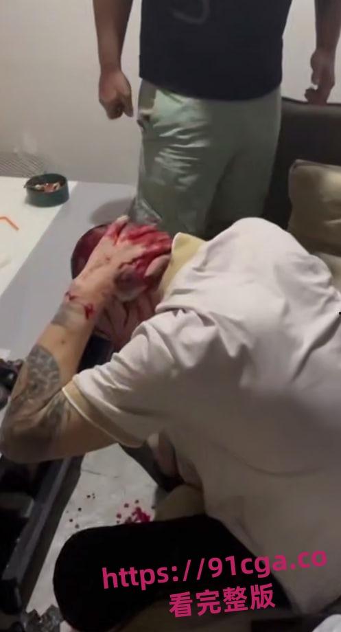 中国绑匪在菲律宾内讧 上演血腥狗咬狗 头破血流枪口相向-4