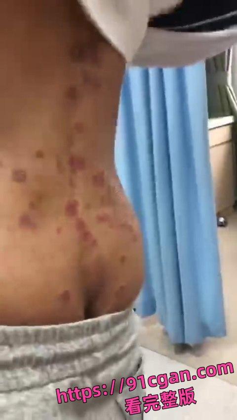 初三男生 年纪轻轻就集齐梅毒和艾滋于一身！这症状都3期了吧 还死不承认！-1