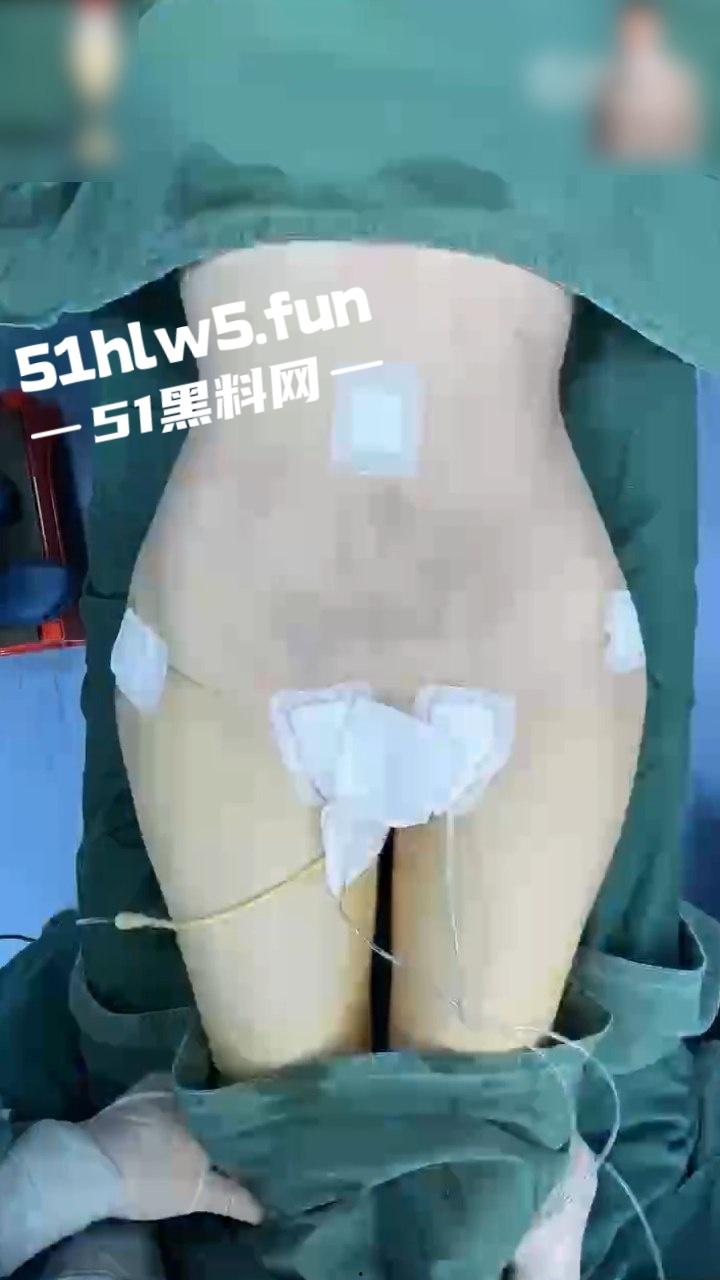 实拍整形医院,小仙女整容抽脂和填充全过程,看着残忍但做完后惊艳的效果让人震撼。-3