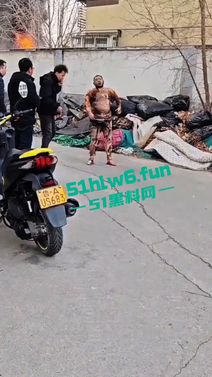 山东济南一小区发生火灾，男子被烧的体无完肤，经调查是邻居大妈积攒的废品导致烧成这样也太惨了。-2